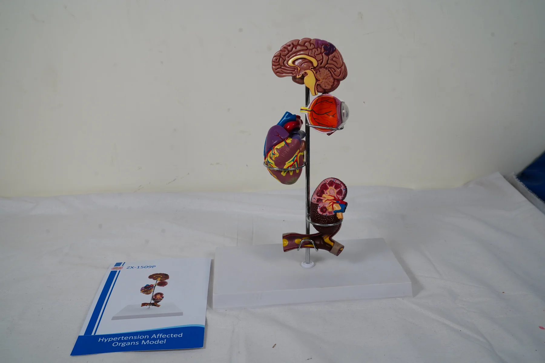 Hypertension Affected Organs Model thumbnail 6
