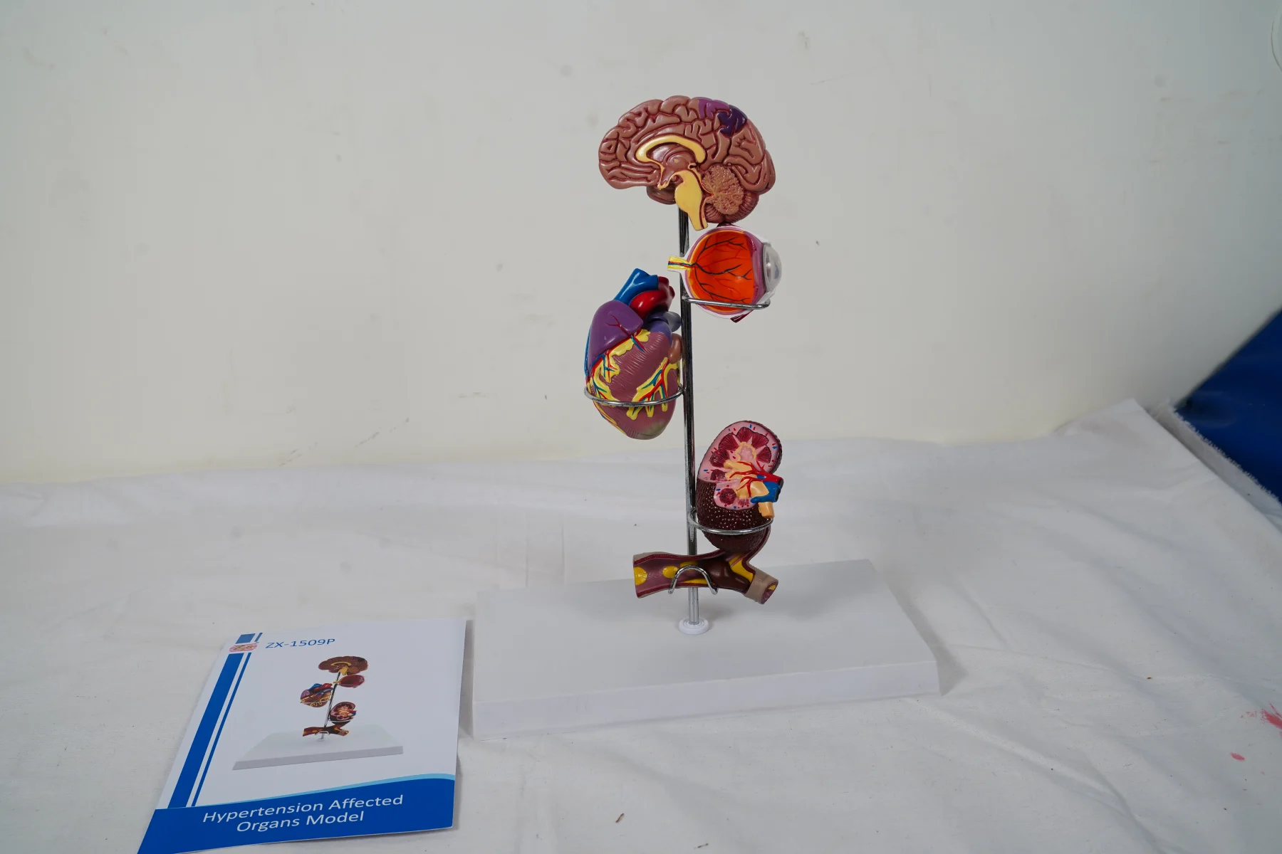 Hypertension Affected Organs Model thumbnail 2