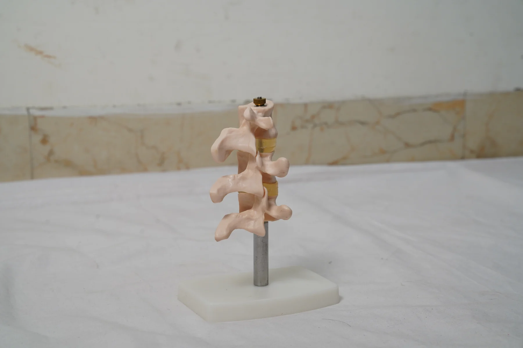 Cutaway Osteoporosis thumbnail 3