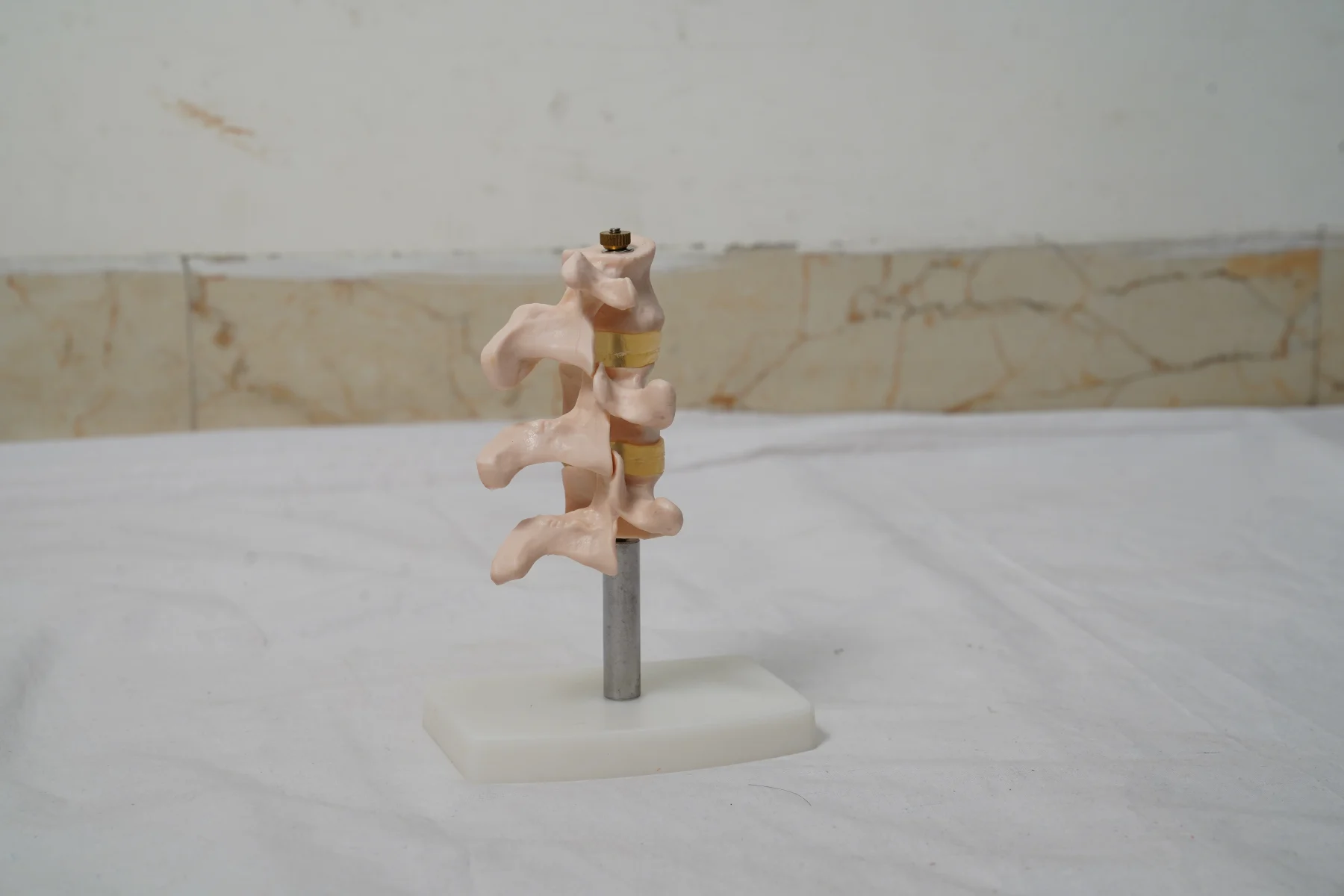 Cutaway Osteoporosis thumbnail 2