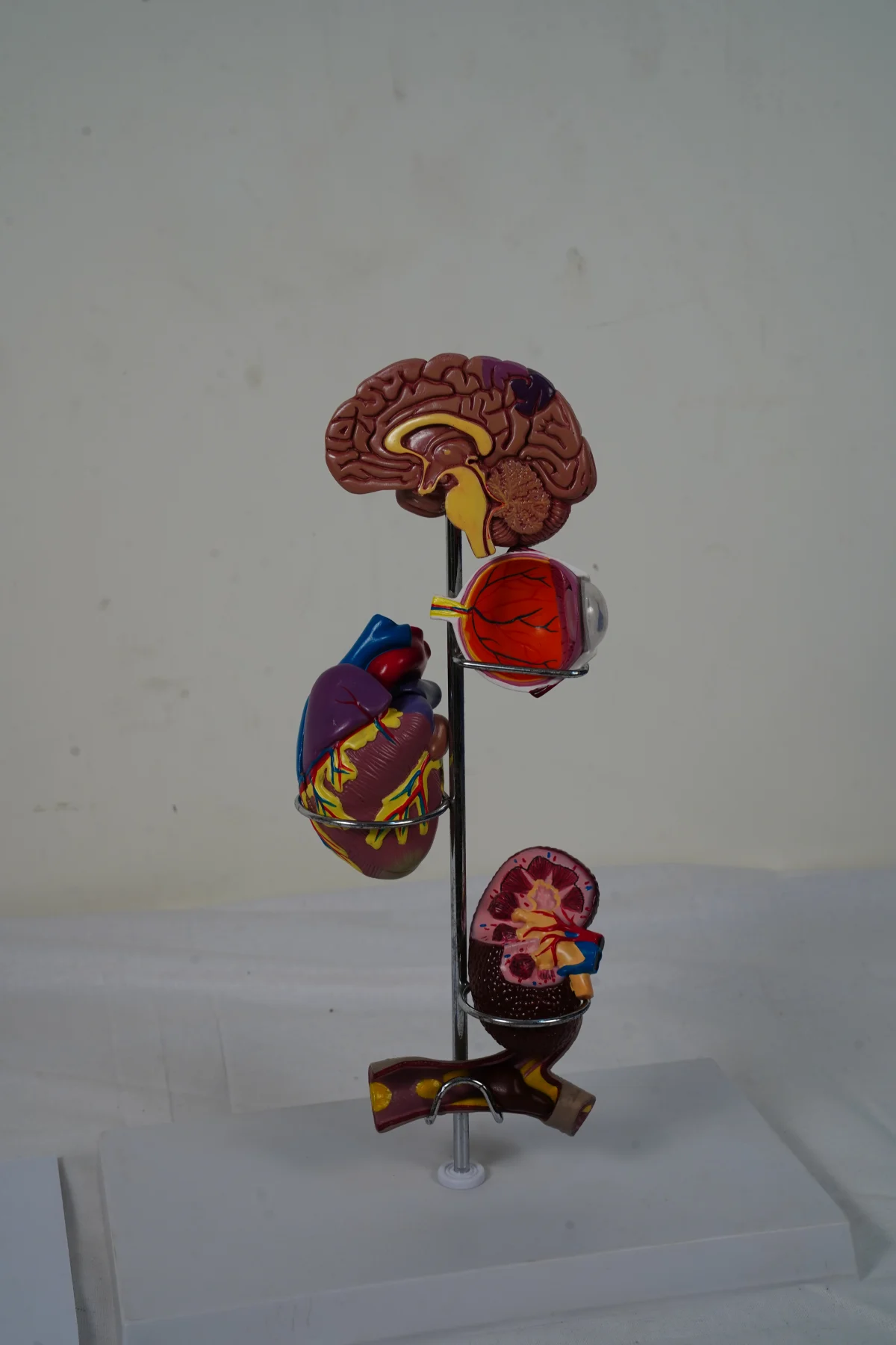 Hypertension Model