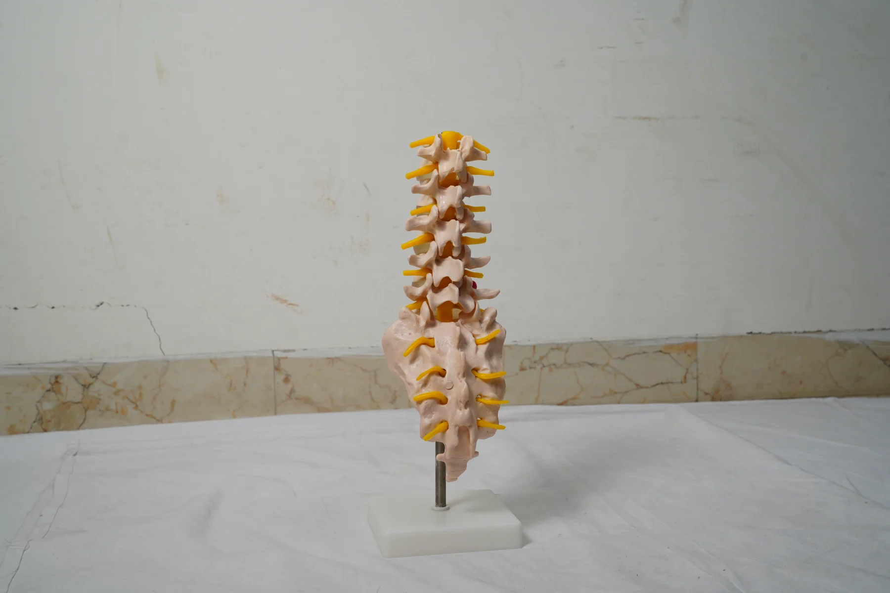 Life Size Lumbar Vertebrae With Sacrum Coccyx and Herniated Disc thumbnail 3