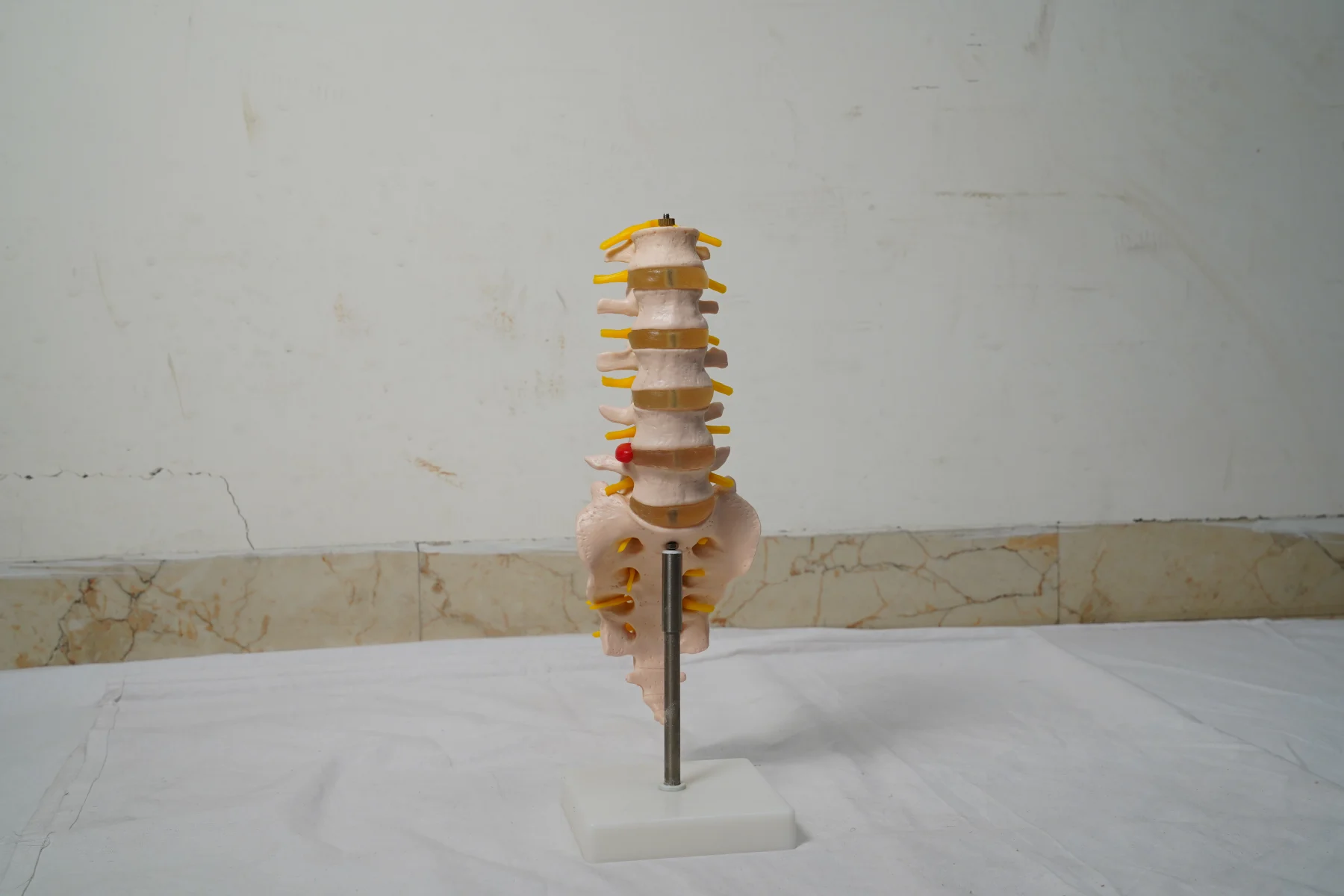 Life Size Lumbar Vertebrae With Sacrum Coccyx and Herniated Disc thumbnail 4