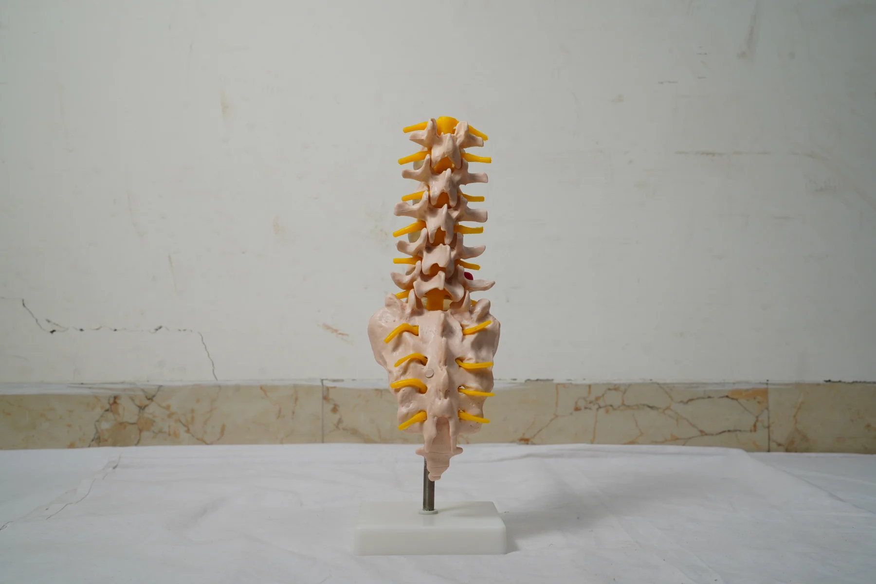 Life Size Lumbar Vertebrae With Sacrum Coccyx and Herniated Disc thumbnail 2