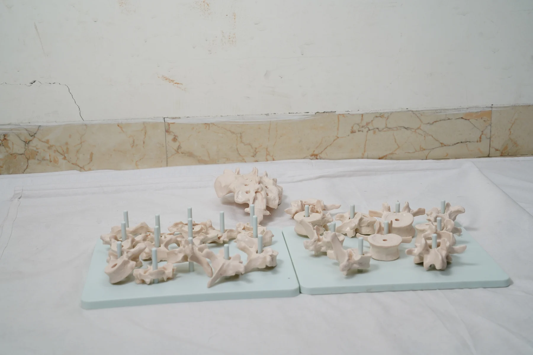 Life Size Vertebral Column Disarticulate Model