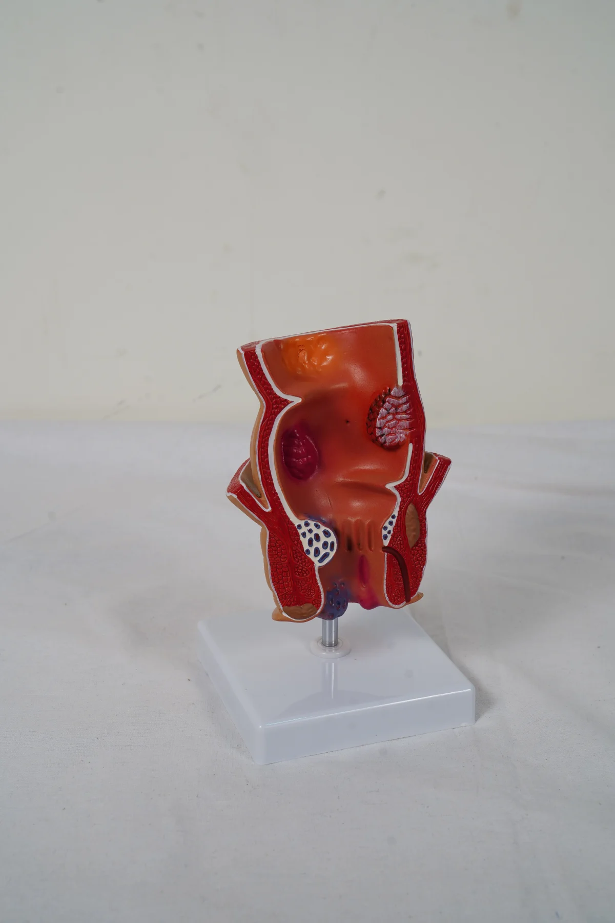 Rectum Model thumbnail 2