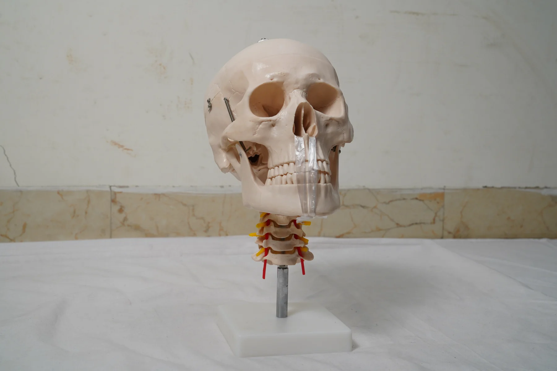 Skull with Cervical Spine thumbnail 2