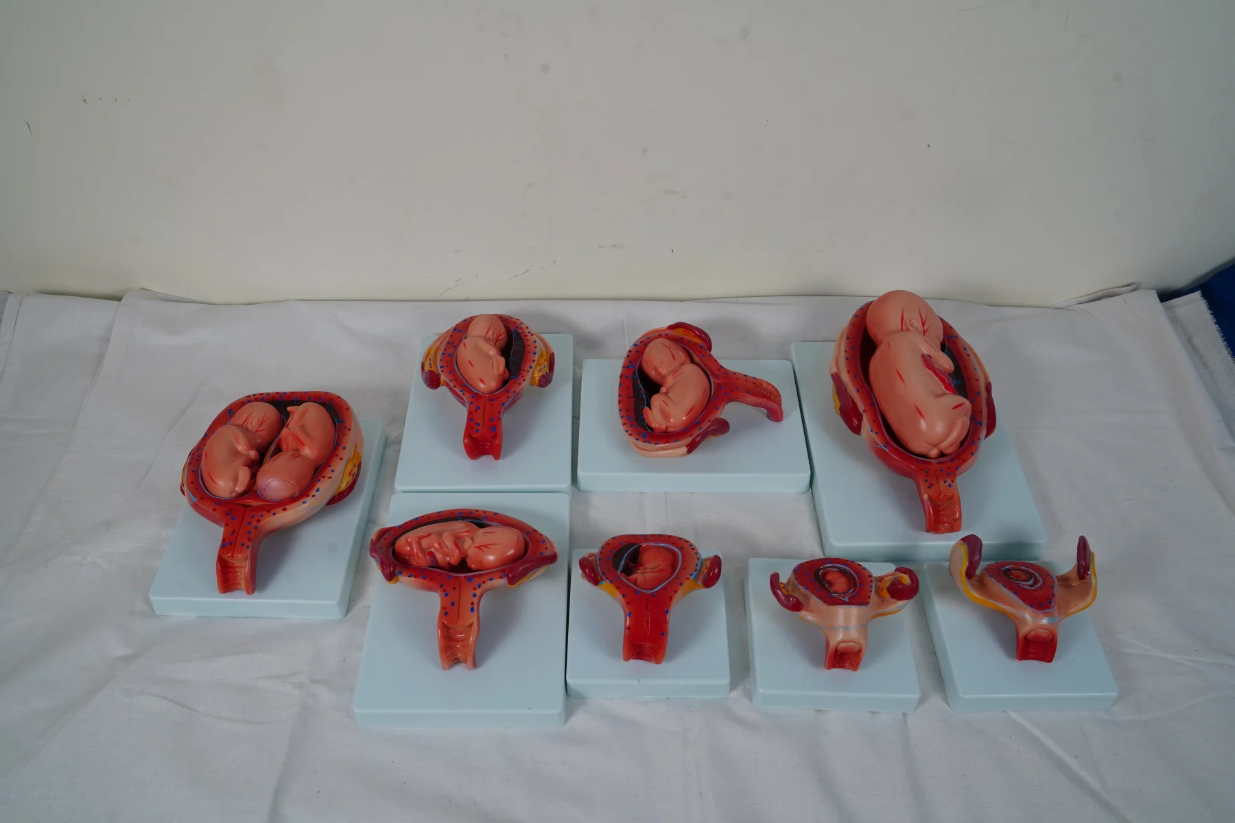 The Development Process for Fetus (Half Size) thumbnail 3