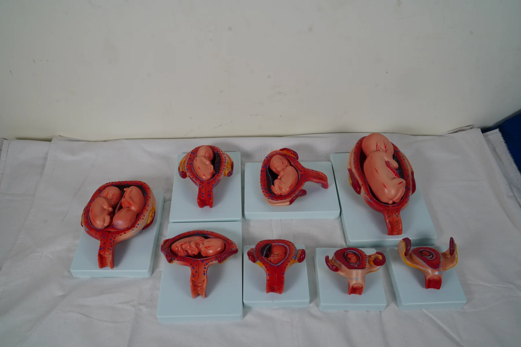 The Development Process for Fetus (Half Size) thumbnail 4