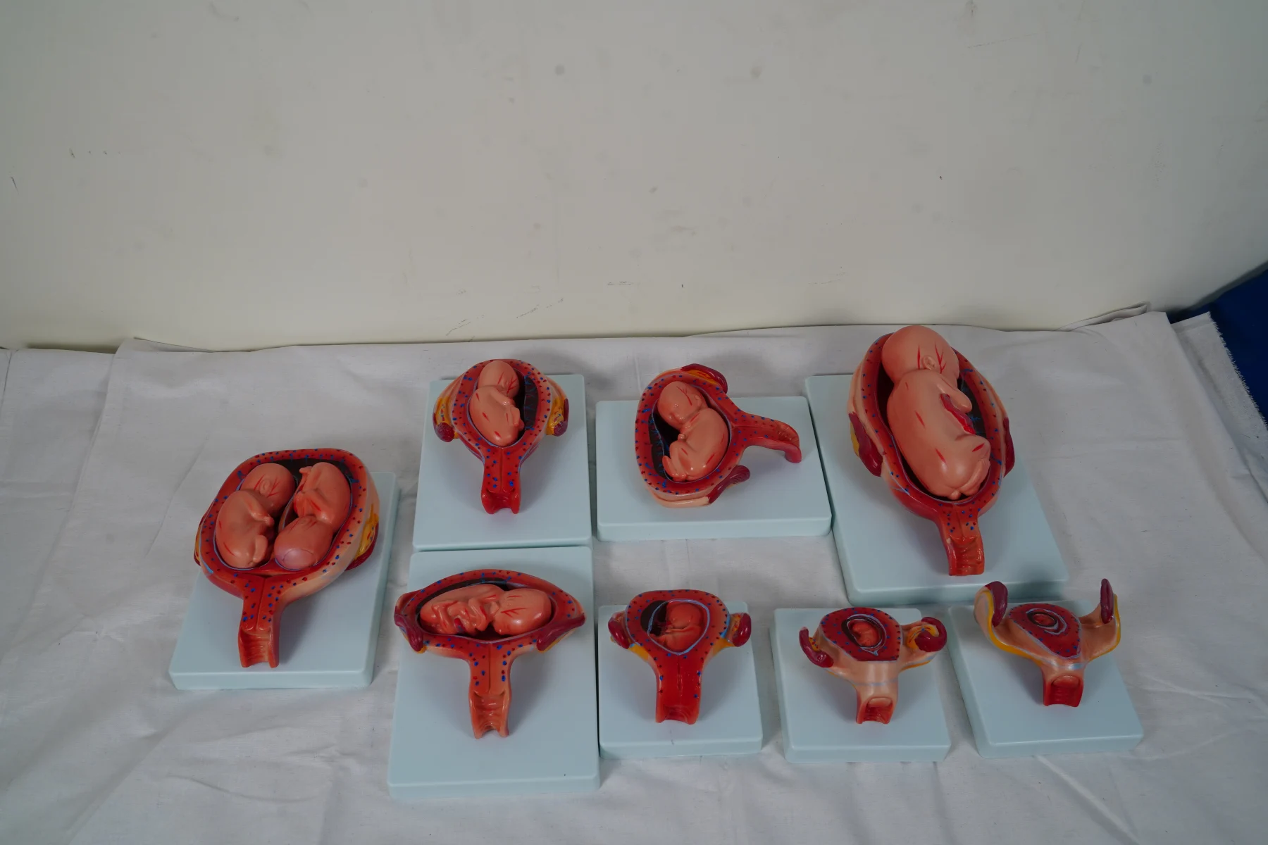 The Development Process for Fetus (Half Size) thumbnail 5