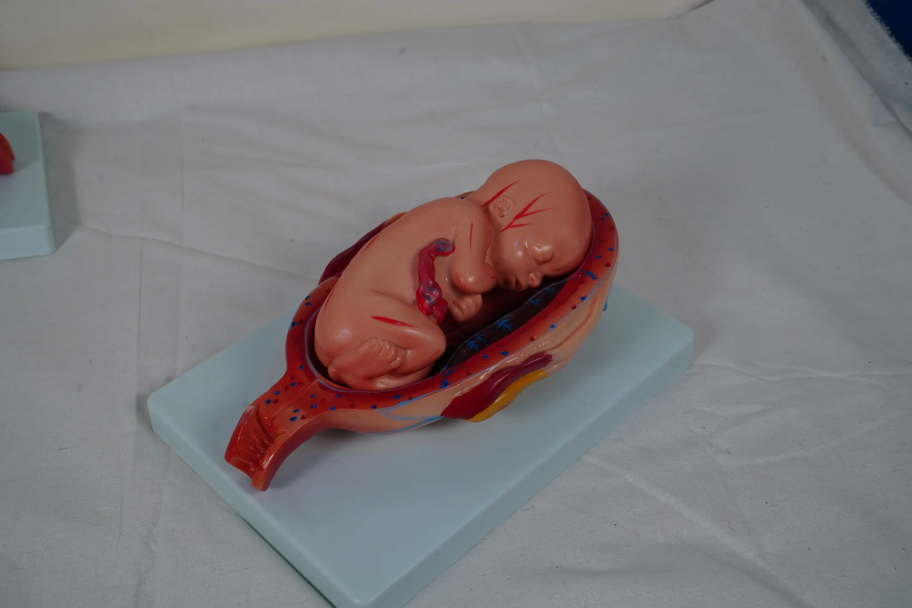 The Development Process for Fetus (Half Size) thumbnail 7