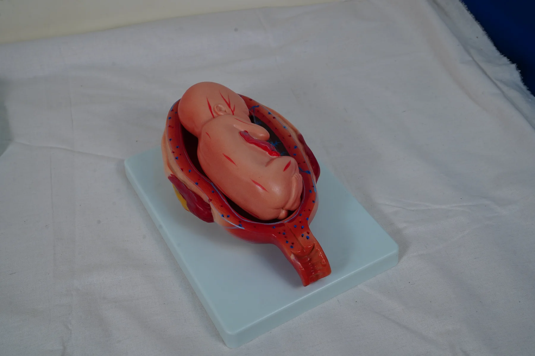 The Development Process for Fetus (Half Size) thumbnail 8
