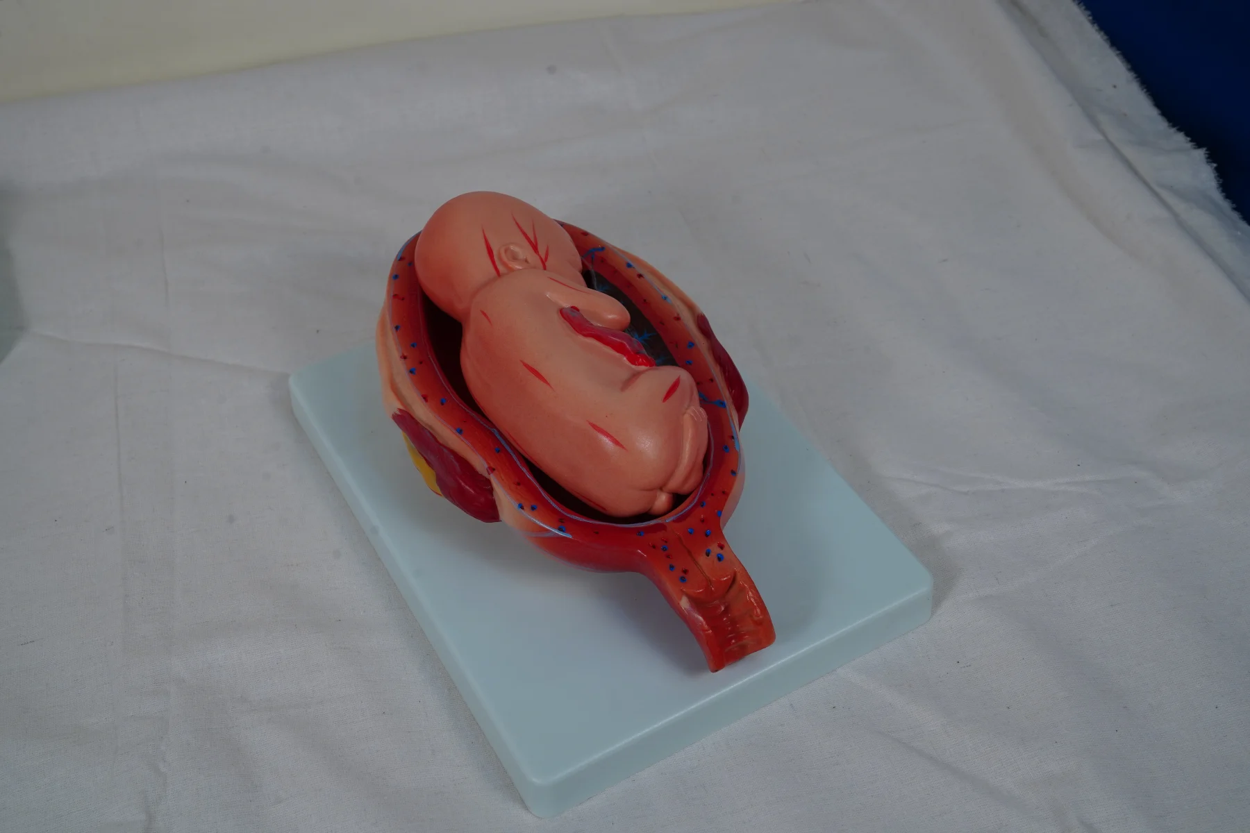 The Development Process for Fetus (Half Size) thumbnail 9