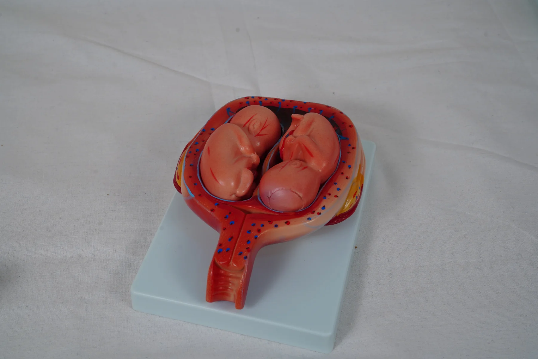 The Development Process for Fetus (Half Size) thumbnail 13