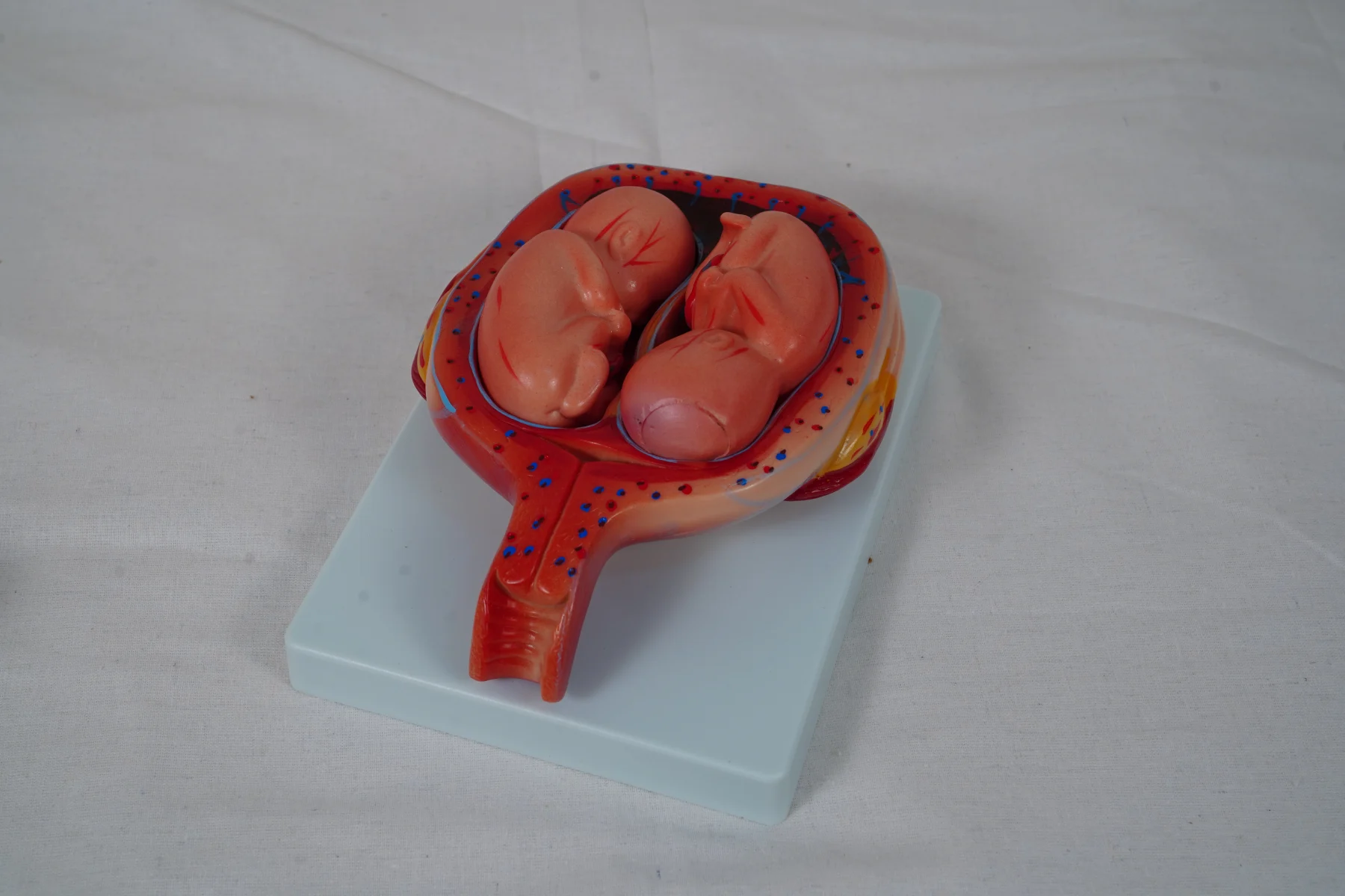 The Development Process for Fetus (Half Size) thumbnail 14