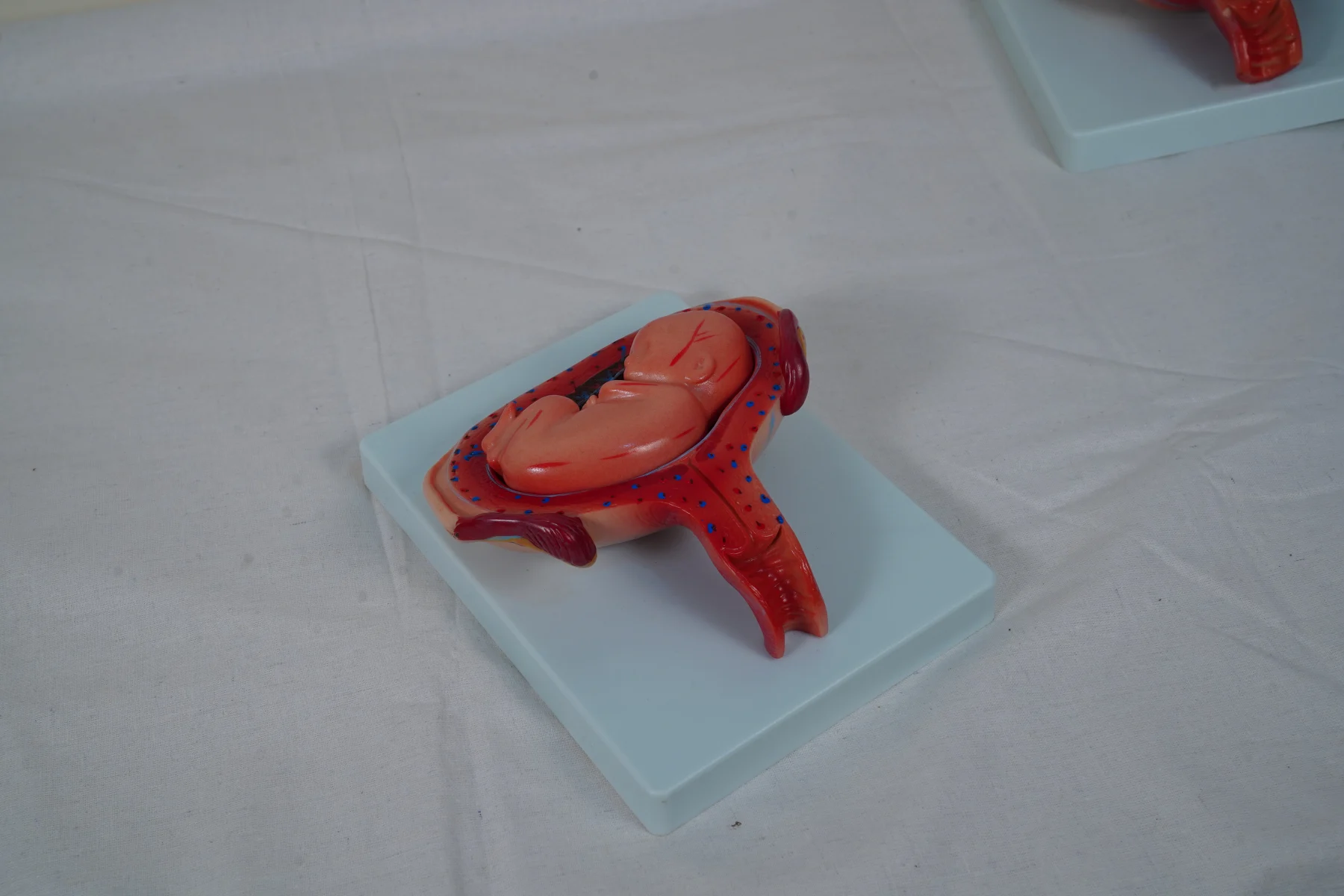 The Development Process for Fetus (Half Size) thumbnail 10