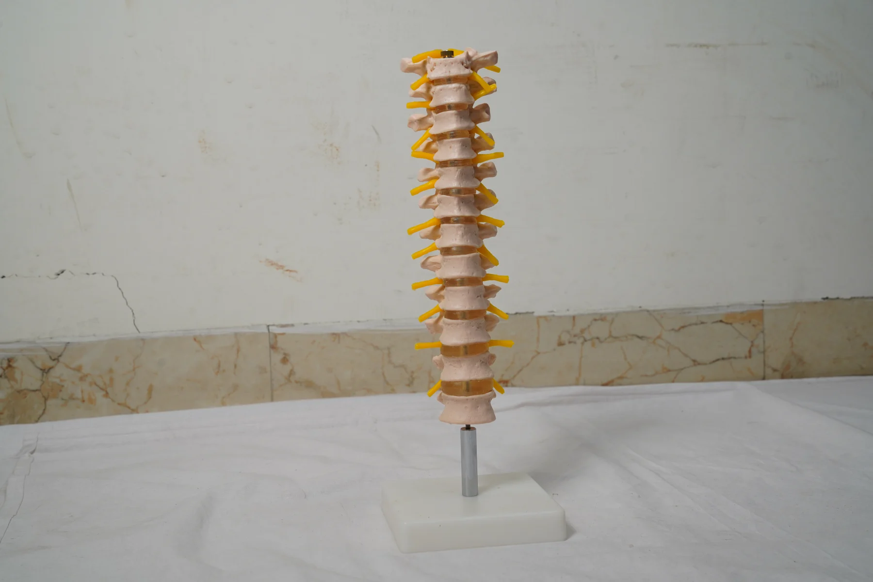 Thoracic Spinal Column thumbnail 2
